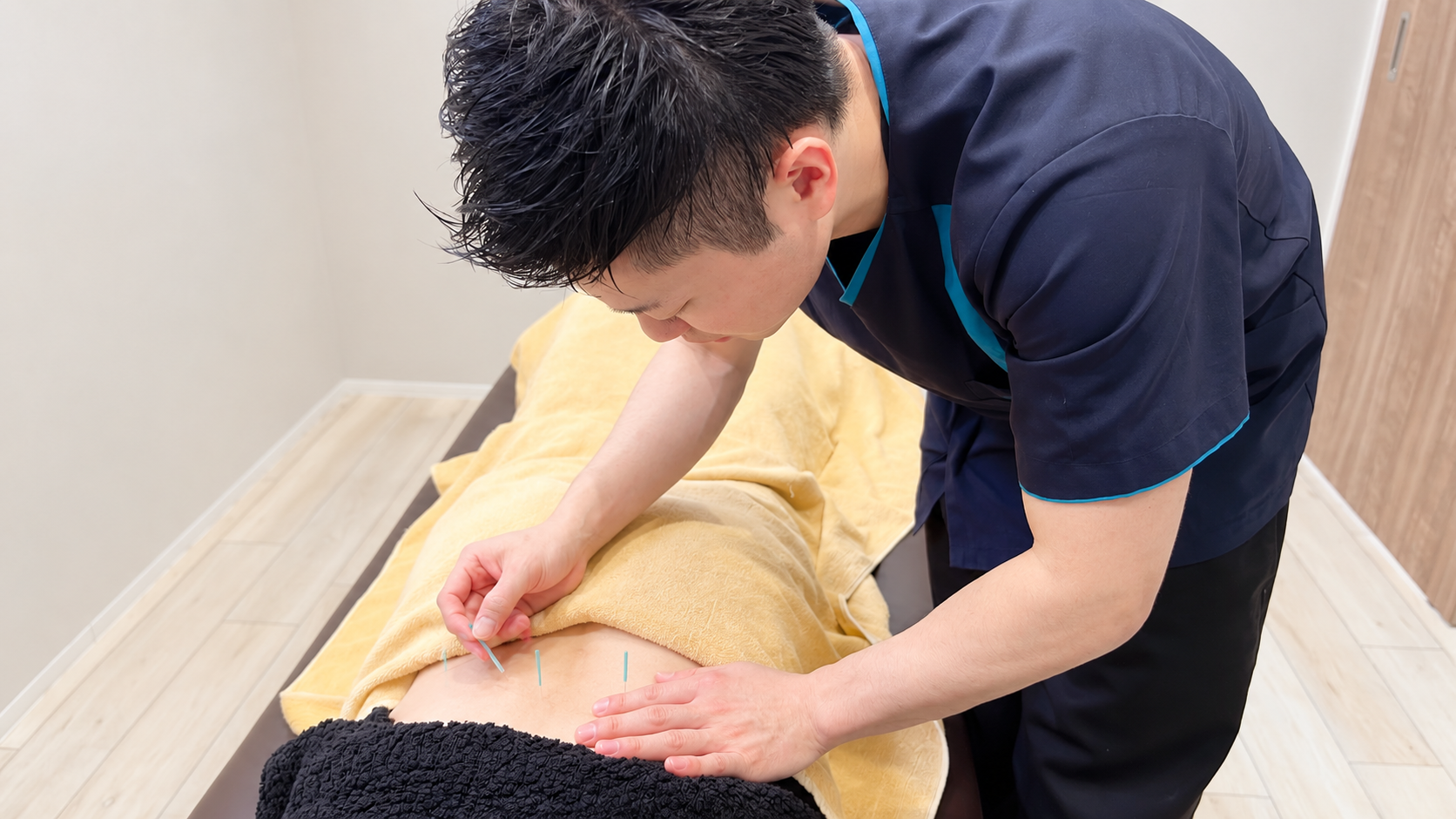 筋肉・関節への鍼施術の様子（仮画像）
