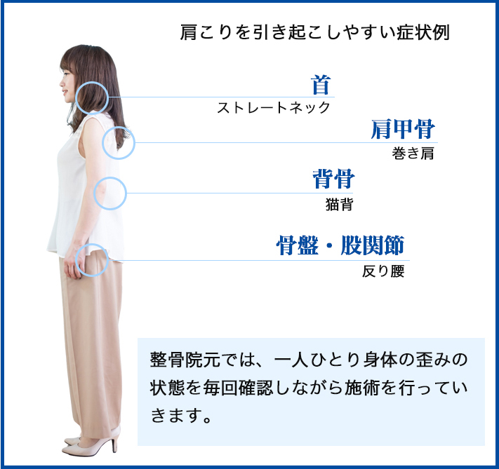 肩こりを引き起こしやすい症状例