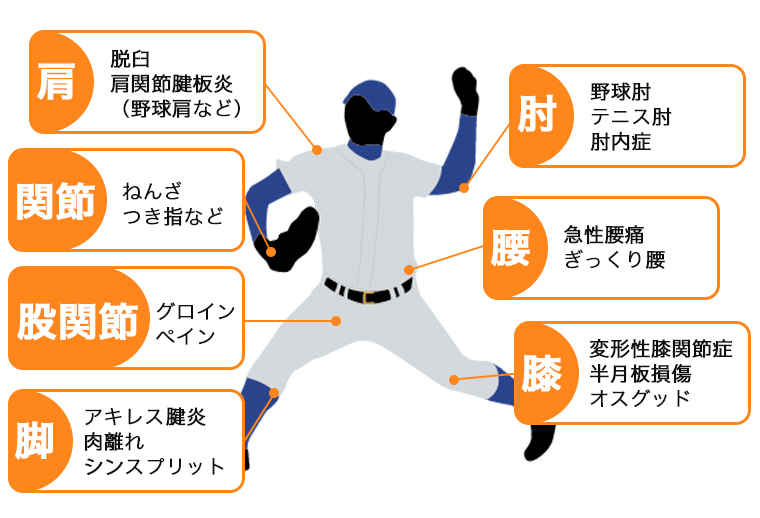 代表的なスポーツ外傷