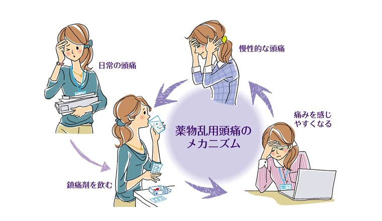 薬物乱用頭痛の仕組み